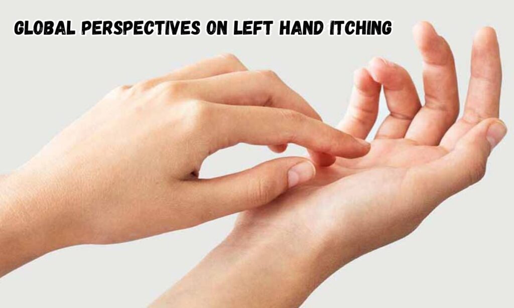 Global Perspectives on Left Hand Itching