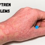 Loguytren Problems: Causes, Symptoms, and Treatment Solutions