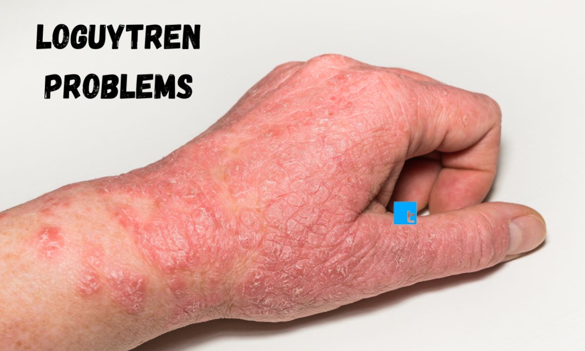 Loguytren Problems: Causes, Symptoms, and Treatment Solutions